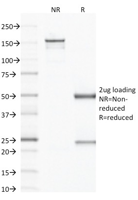 Data from SDS-PAGE analysis of Anti-Factor XIIIa antibody (Clone F13A1/1683). Reducing lane (R) shows heavy and light chain fragments. NR lane shows intact antibody with expected MW of approximately 150 kDa. The data are consistent with a high purity, intact mAb.